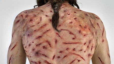 Flagellation Marks on Shroud of Turin